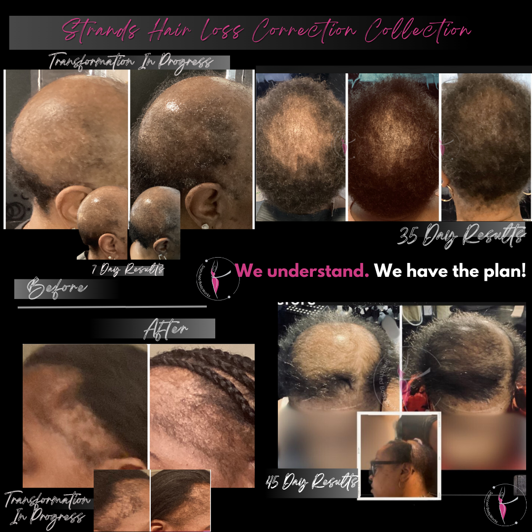 Strands Hair Loss Correction Collection